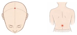 Two anatomical diagrams showing acupoints: one on the crown of the head and one on the lower back along the spine.