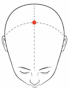 Top‑down diagram of a head, the Bai Hui point with a red dot marking the crown point