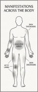 A simple body diagram showing Dampness‑related signs, including skin disorders, digestive issues, achy limbs, and heaviness across different areas.